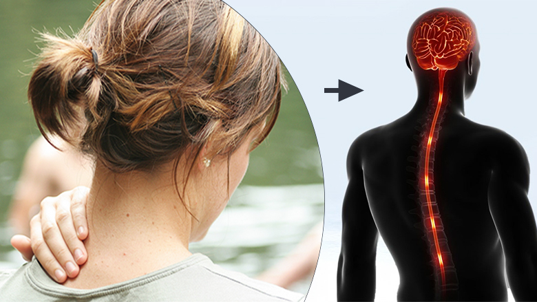 Stem-Cell-Treatment-for-Syringomyelia